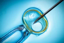 Tüp Bebek (IVF) Tedavisinin Aşamaları Nelerdir?