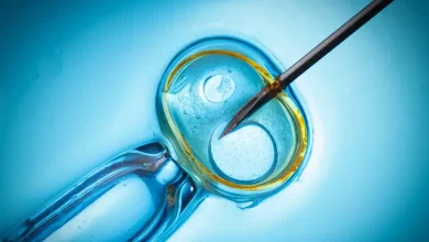 Tüp Bebek (IVF) Tedavisinin Aşamaları Nelerdir?
