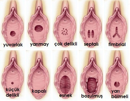Kızlık Zarı Dikimi İstanbul 2 kizlik zari cesitleri