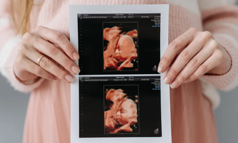 4 Boyutlu Ultrason Nedir? 1 4 Boyutlu Ultrason İstanbul